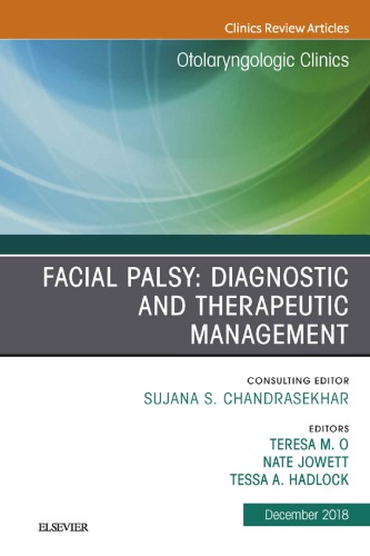 Facial Palsy