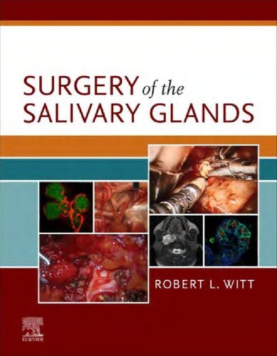 Surgery of the Salivary Glands