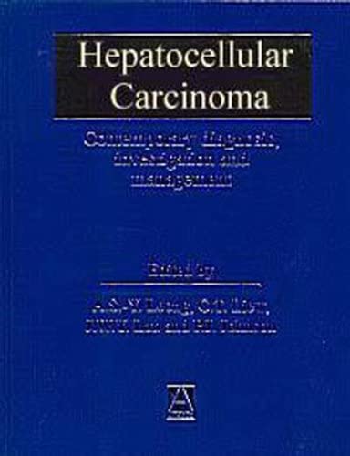 Hepatocellular Carcinoma: Diagnosis, Investigation and Management