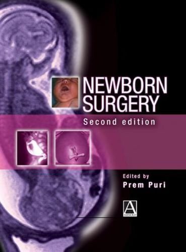 Newborn Surgery