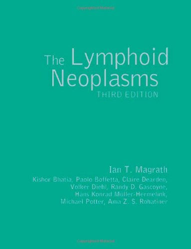 The Lymphoid Neoplasms