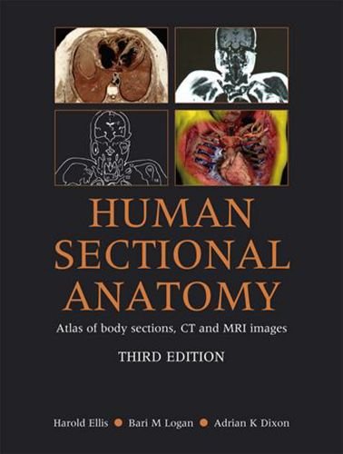 Human Sectional Anatomy