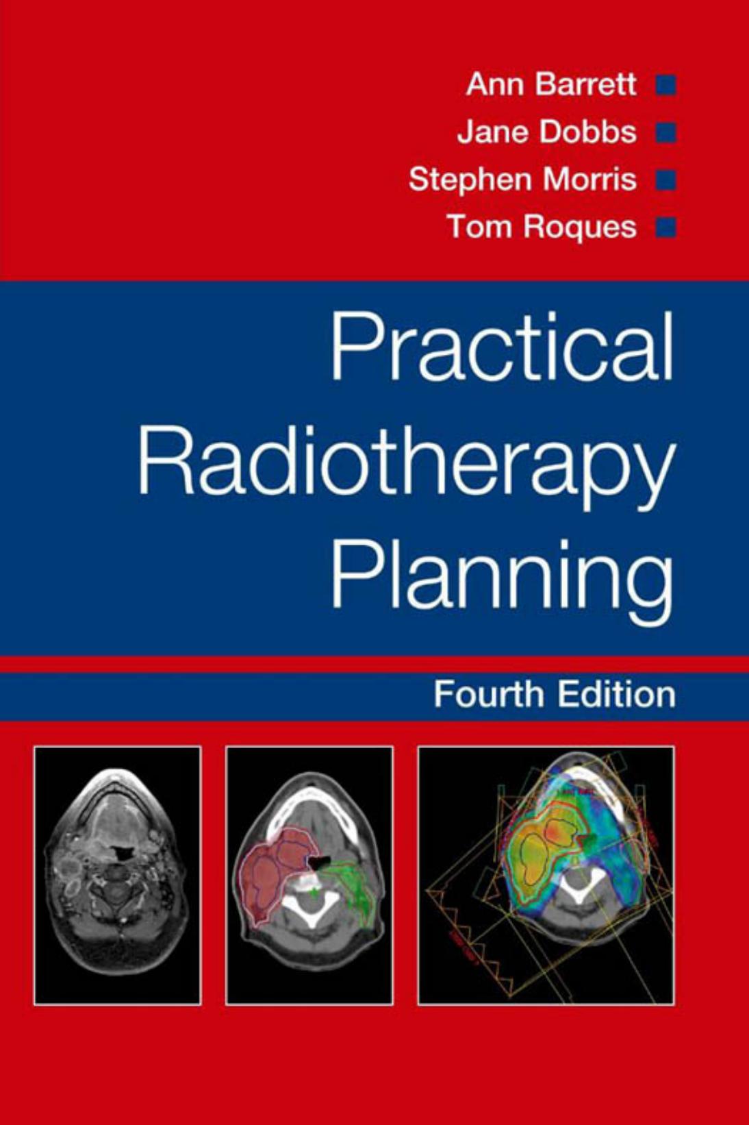 Practical Radiotherapy Planning