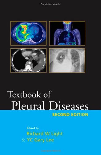 Textbook of Pleural Diseases Second Edition