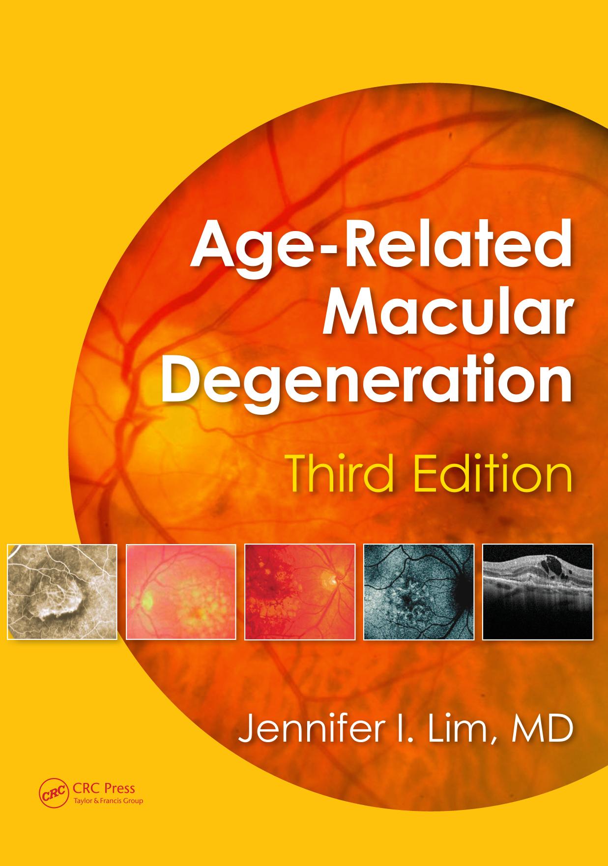 Age-Related Macular Degeneration, Third Edition