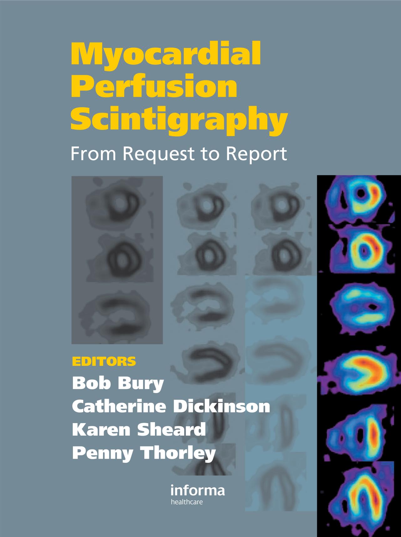 Myocardial Perfusion Scintigraphy