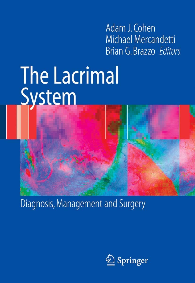 The Lacrimal System: Diagnosis, Management and Surgery