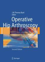 Operative Hip Arthroscopy.