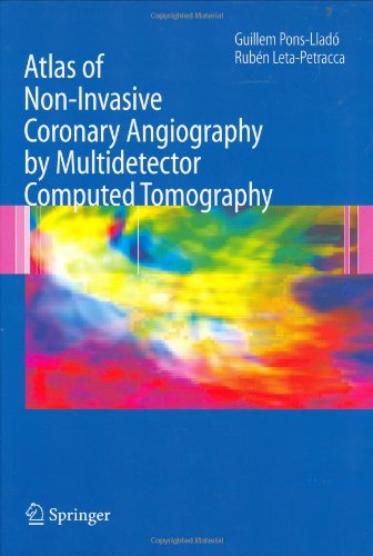 Atlas of Non-Invasive Coronary Angiography by Multidetector Computed Tomography