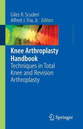 Knee Arthroplasty Handbook