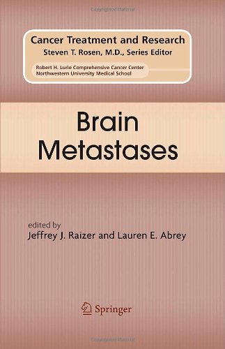 Brain Metastases