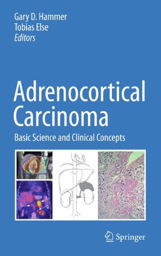 Adrenocortical Carcinoma : Basic Science and Clinical Concepts