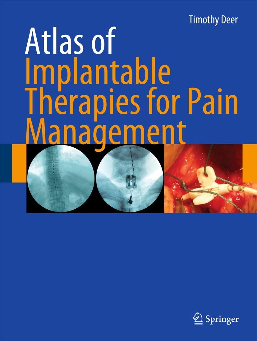 Atlas of Implantable Therapies for Pain Management