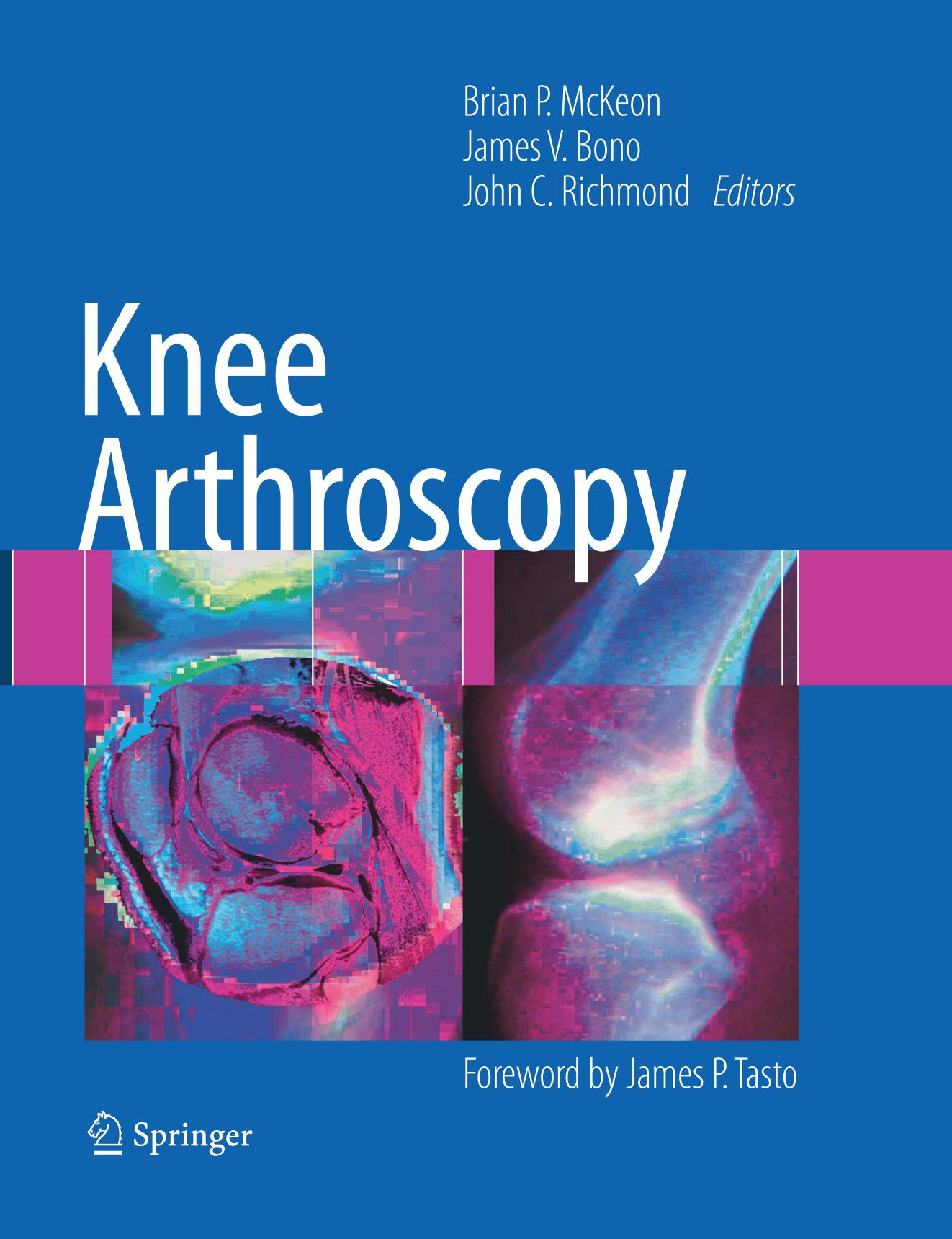 Knee Arthroscopy