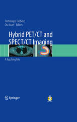 Hybrid Pet/CT and Spect/CT Imaging