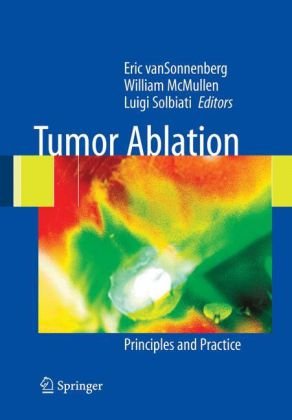 Tumor Ablation