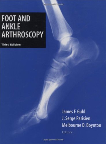 Foot and Ankle Arthroscopy