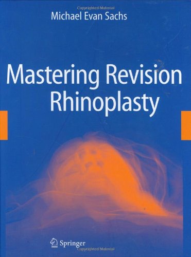 Mastering Revision Rhinoplasty