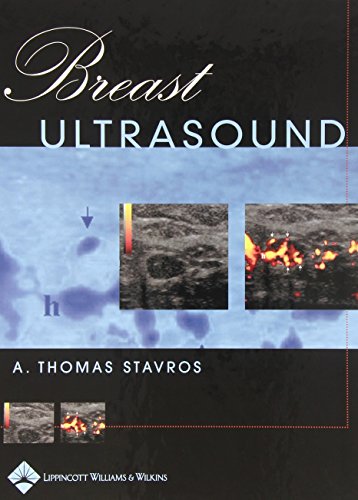 Breast Ultrasound