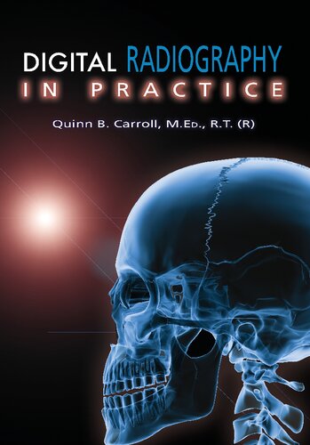 Digital Radiography in Practice