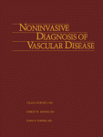 Noninvasive diagnosis of vascular disease