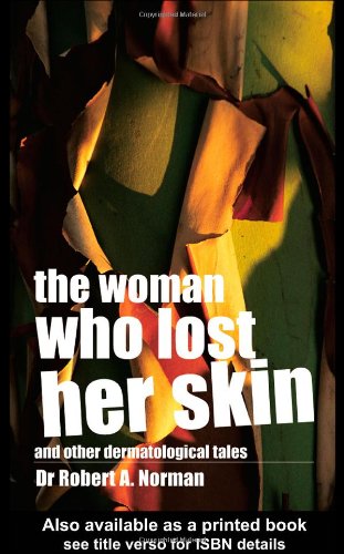 The Woman Who Lost Her Skin