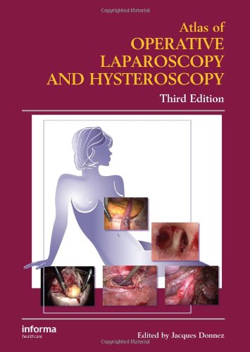 Atlas of Operative Laparoscopy and Hysteroscopy