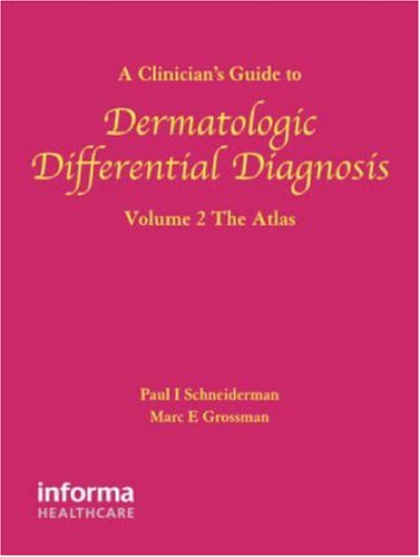 A Clinician's Guide to Dermatologic Differential Diagnosis, Volume 2