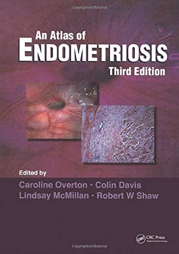 Atlas of Endometriosis (Encyclopedia of Visual Medicine Series)