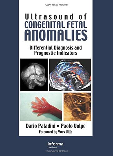 Ultrasound of Congenital Fetal Anomalies: Differential Diagnosis and Prognostic Indicators