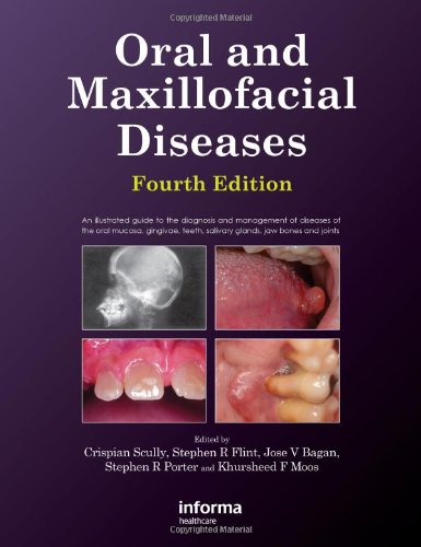 Oral and Maxillofacial Diseases, Fourth Edition