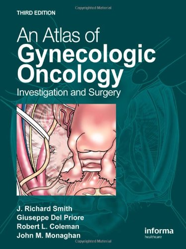 An Atlas of Gynecologic Oncology