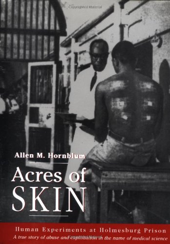 Acres of Skin