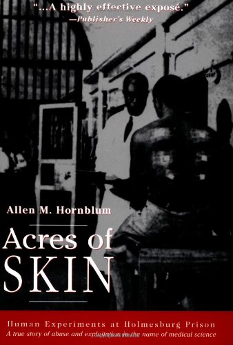 Acres of Skin