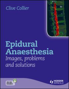 Epidural anaesthesia : images, problems and solutions