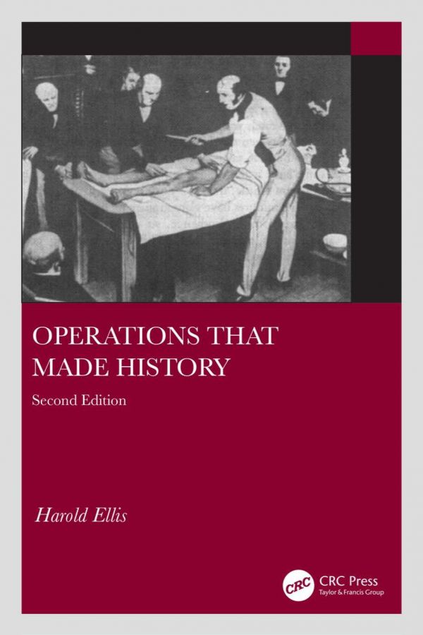 Operations that made history