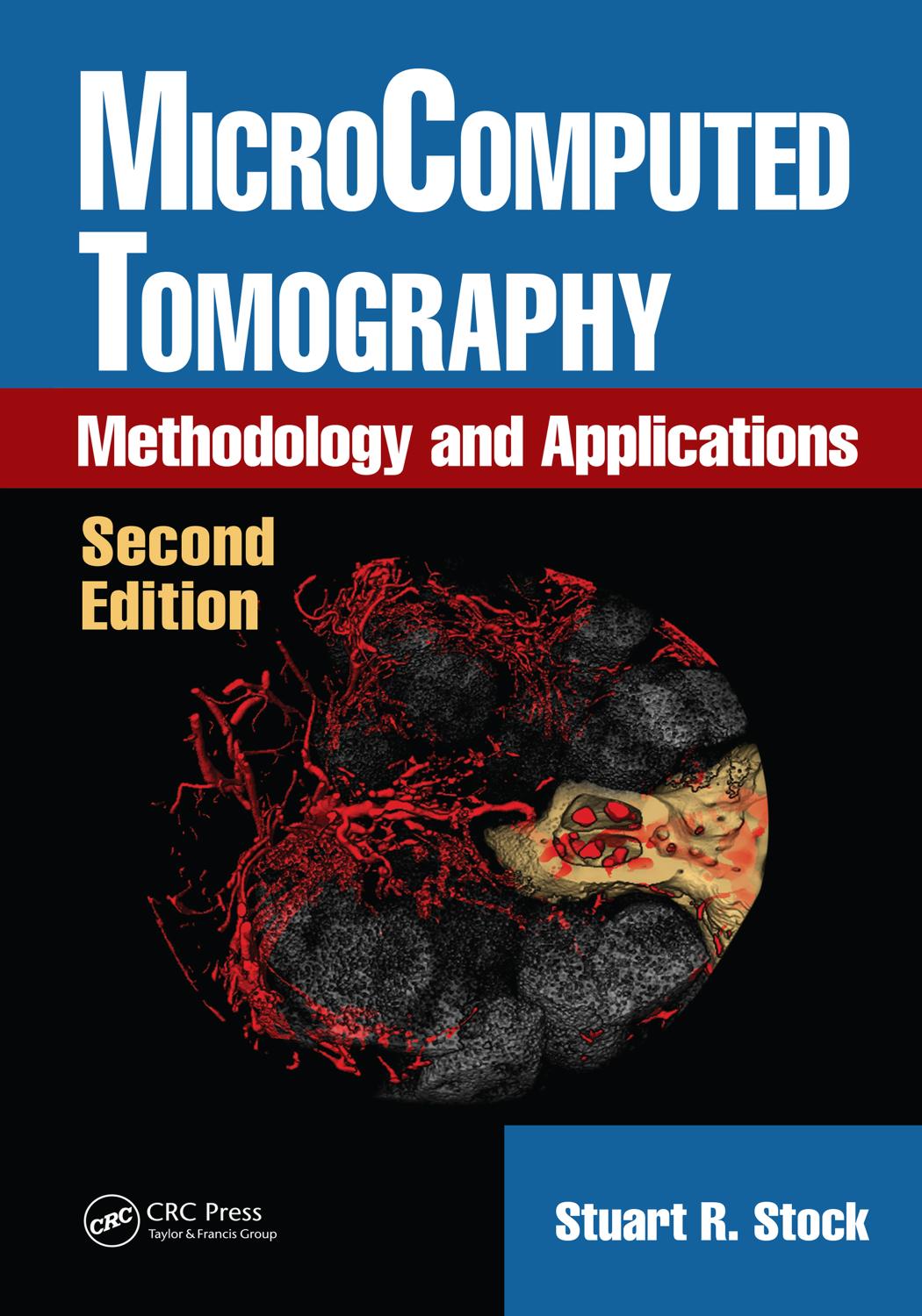 Microcomputed tomography methodology and applications