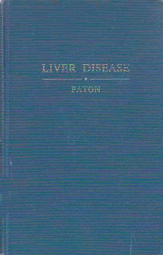 Liver disease,