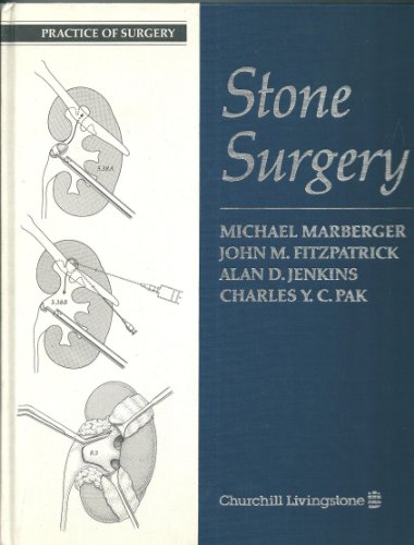 Stone Surgery