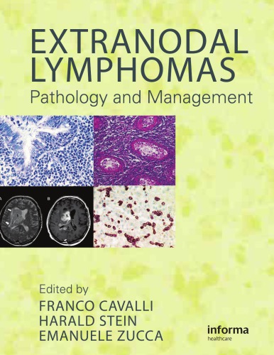 Extranodal Lymphomas