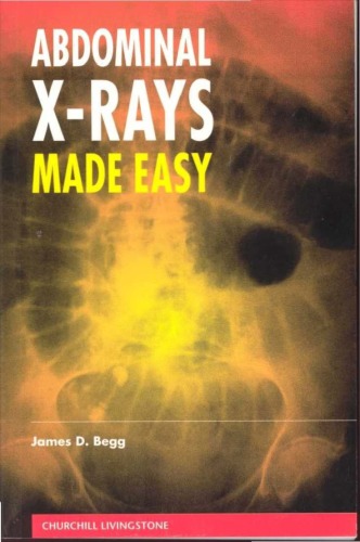 Abdominal X-Rays Made Easy
