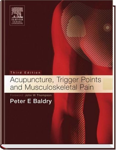 Acupuncture, Trigger Points and Musculoskeletal Pain