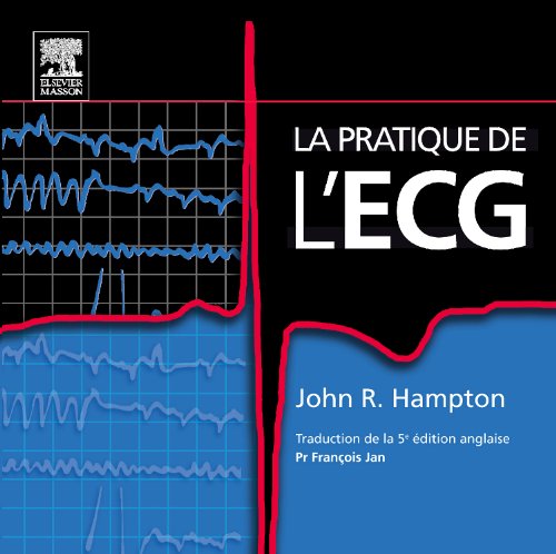 The ECG in Practice