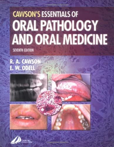 Cawson's Essentials of Oral Pathology and Oral Medicine