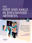 The Foot and Ankle in Rheumatoid Arthritis