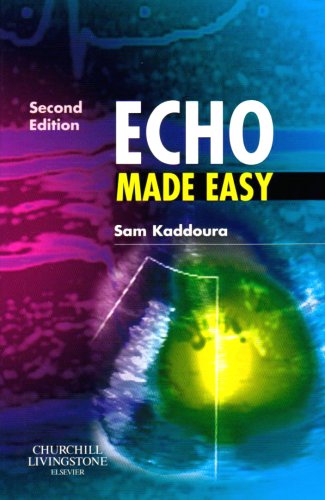 Echo Made Easy