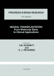 Neural Transplantation