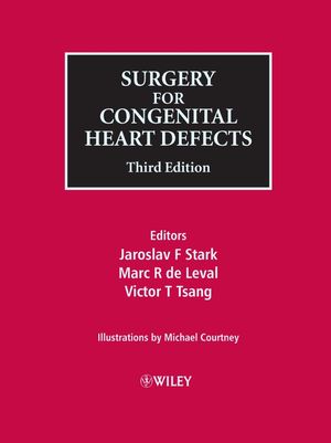 Surgery for congenital heart defects