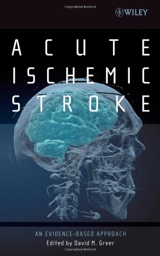 Acute Ischemic Stroke