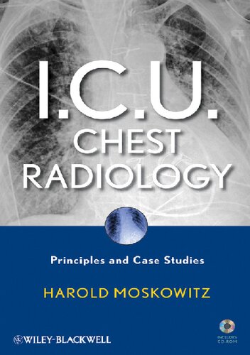 I.C.U. Chest Radiology